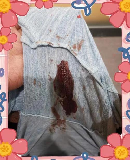 孕妇梦见带血的卫生巾_2