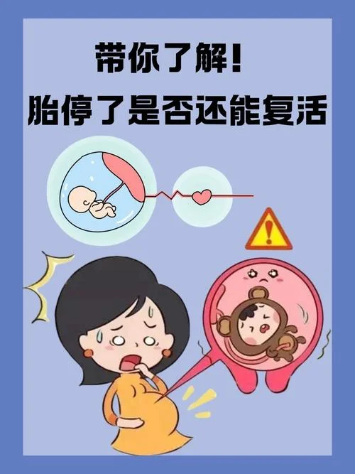 梦见胎死腹中-胎死腹中梦