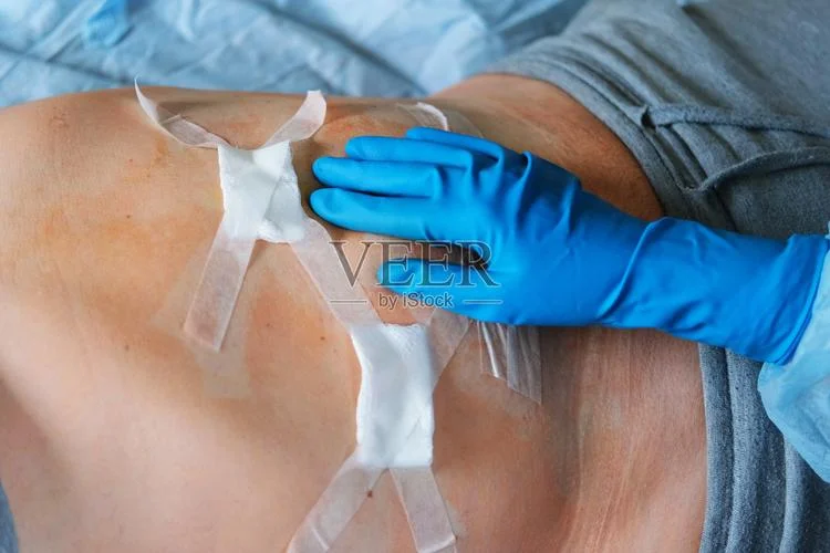 注水腹腔镜检查怎么做_2