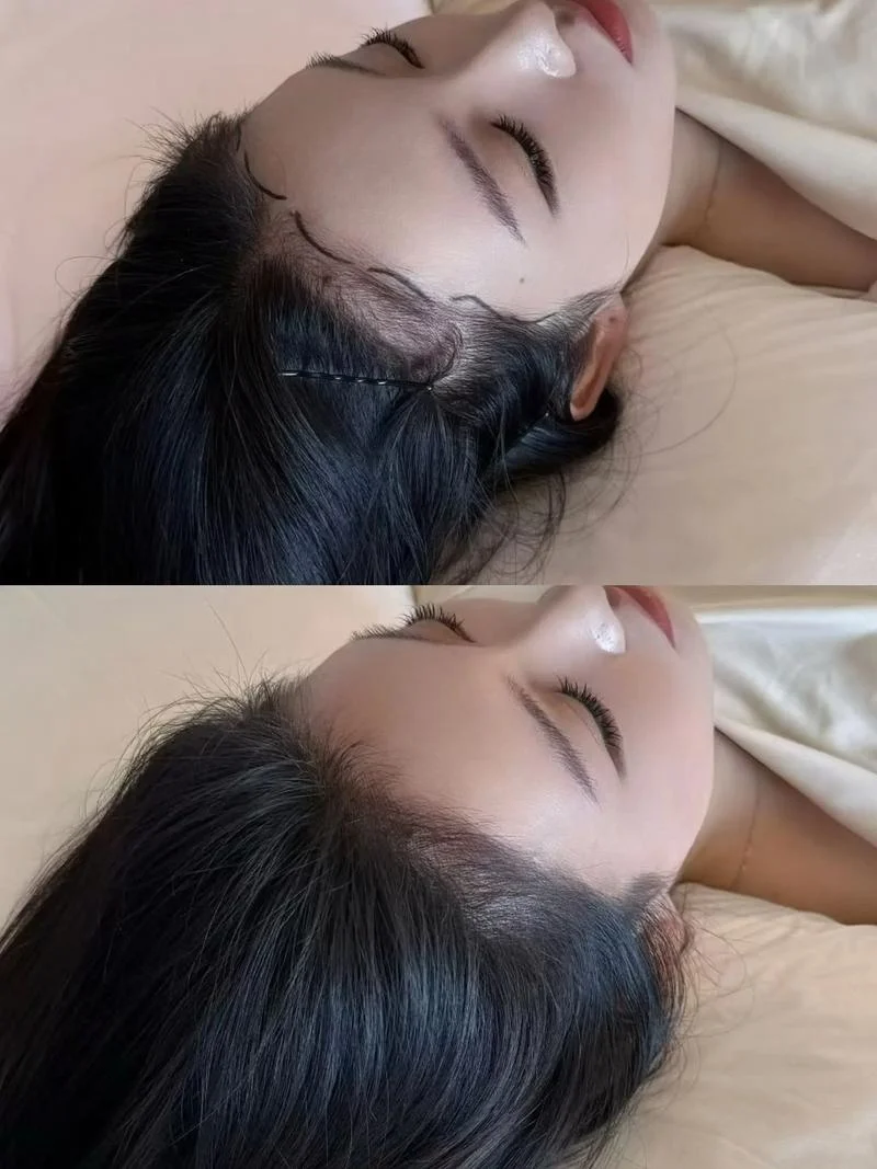 梦见发际线变高_2