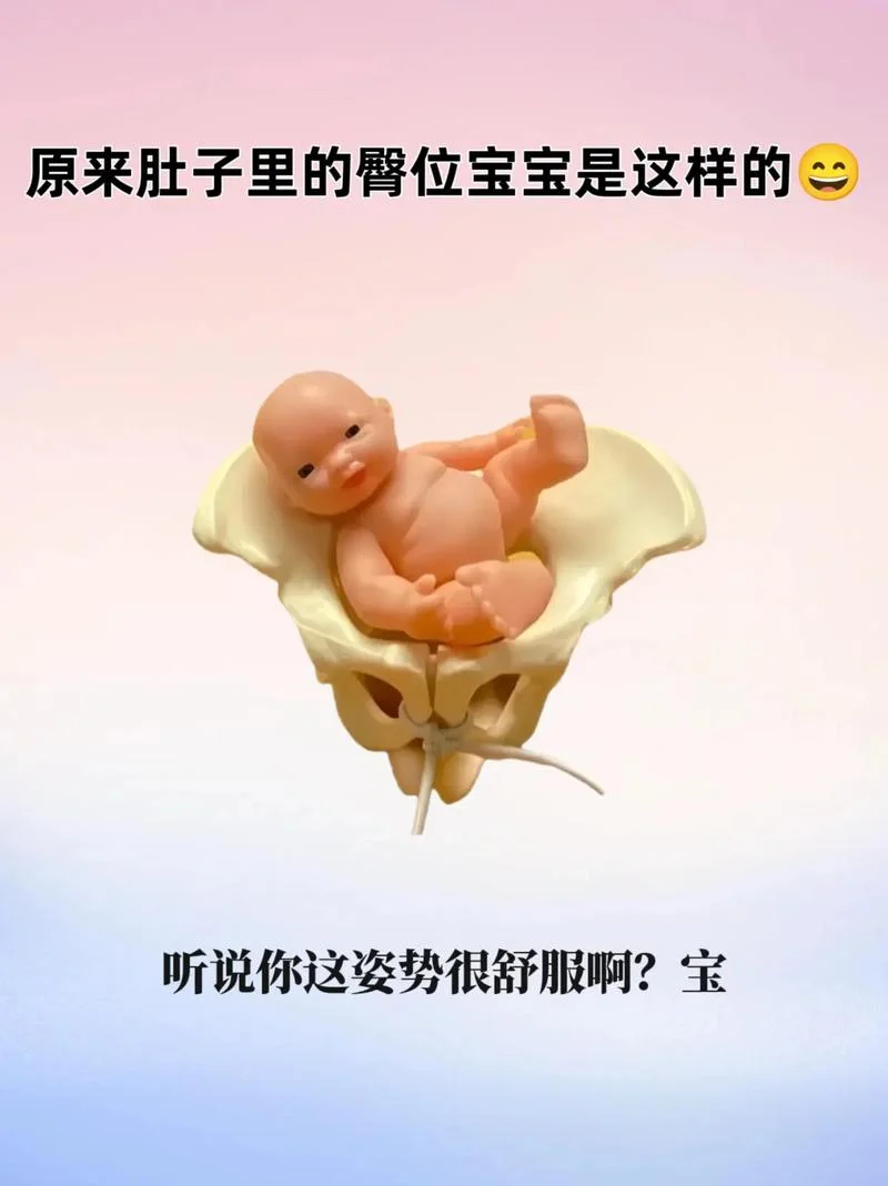 23周胎位臀位是什么意思_1