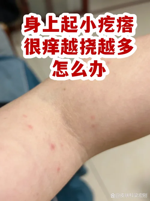 皮肤痒了十几年怎么办-十几年皮肤痒怎么办