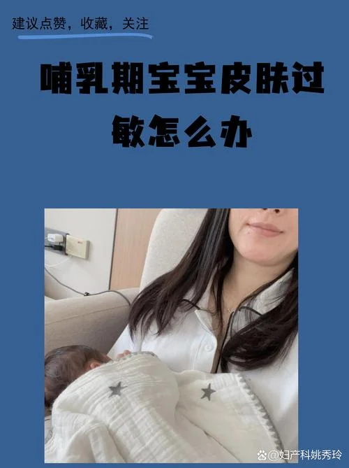 什么是乳糖过敏_1