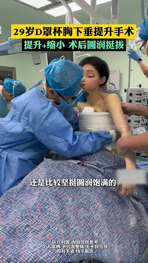 怎么做隆胸手术_1