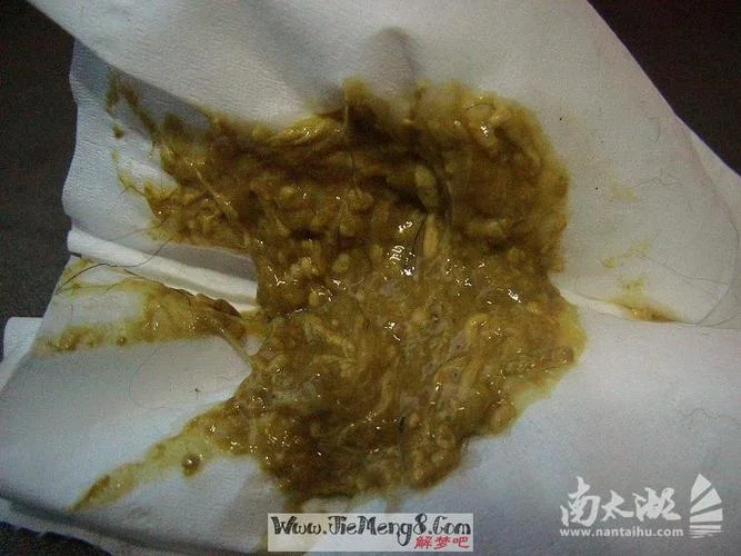 梦见厕所里到处是大便-梦见厕所遍地是便