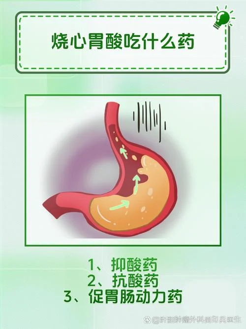 老是胃酸烧心怎么办_2