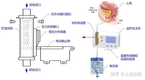 监护设备工作原理_2