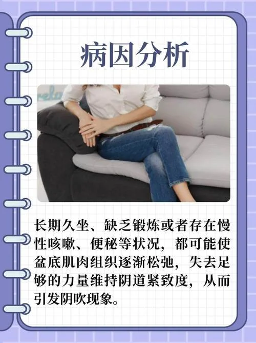 什么是阴吹啊_2