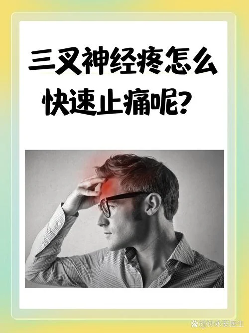 什么是三叉神经痛-什么是三叉神经痛