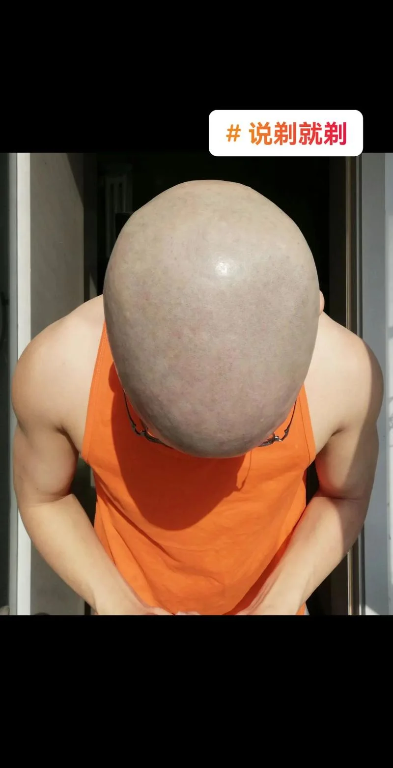 做梦被人剃头了_2