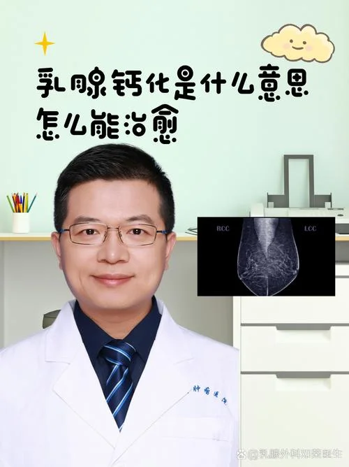 双乳钙化灶是什么意思_1