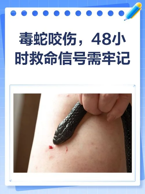 做梦梦到蛇咬人-梦见蛇咬人
