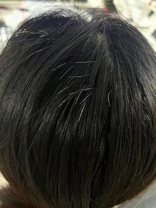 头顶中间长白发面相-头顶白发中间长