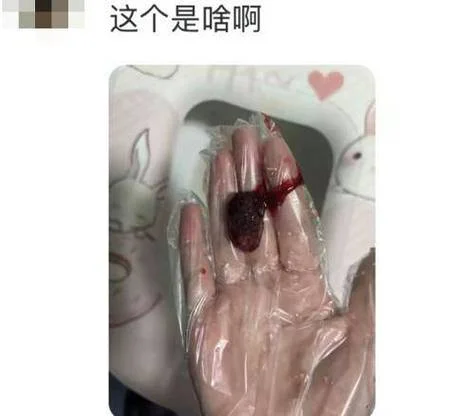 梦见月经血弄在了手上-手沾经血之梦