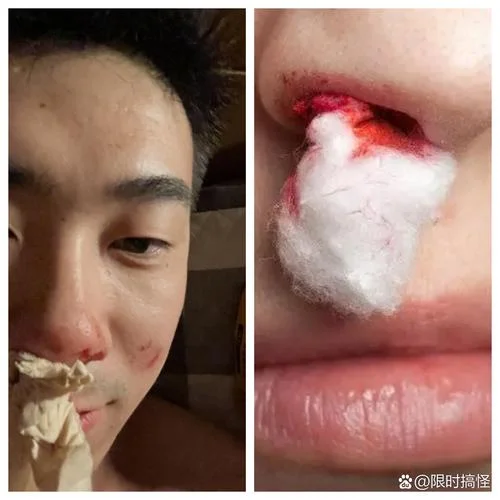 做梦刮胡子刮破脸_2