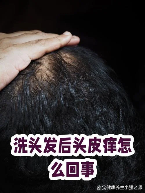 头皮洗不干净怎么办-头皮洗不干净怎么办