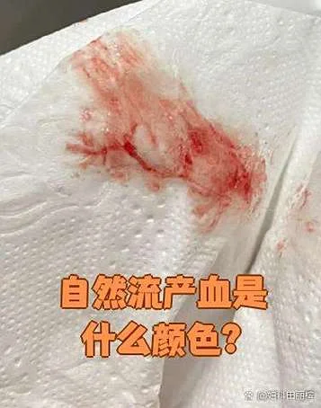 梦到别人流很多的血-梦见他人大量流血