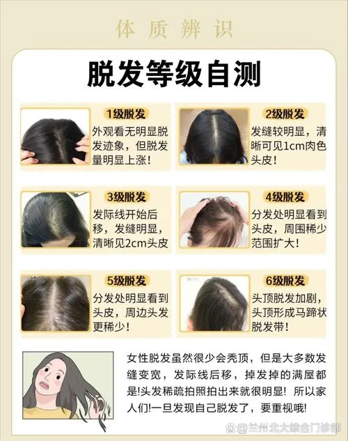脱发是缺什么_1