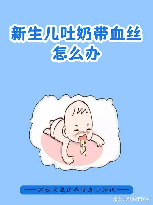 婴儿吐奶怎么办好-婴儿吐奶怎么办