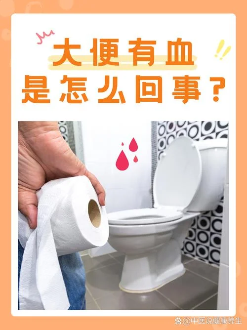 大便喷血滴鲜血怎么办-大便喷鲜血怎么办