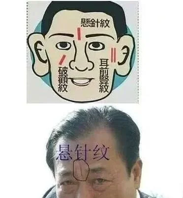 额头竖纹叫什么-额头竖纹称鱼尾纹。