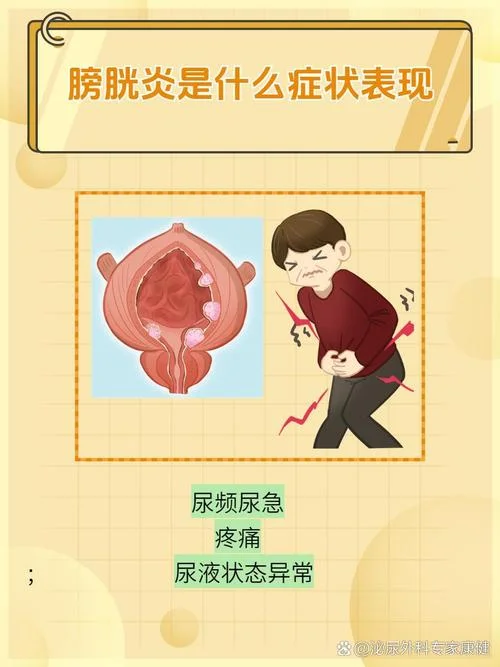 什么是顽固型膀胱炎_2