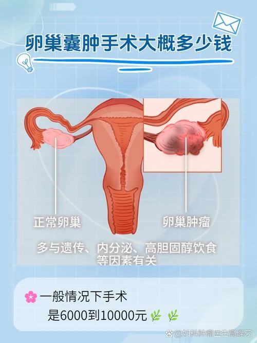 做子宫囊肿手术多少钱-子宫囊肿手术费用