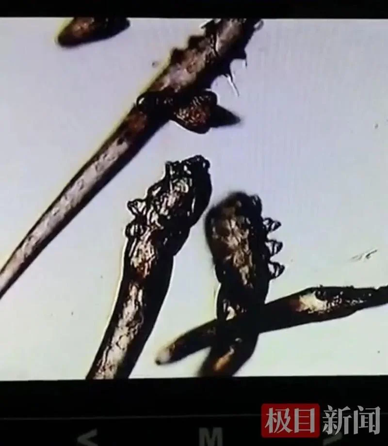梦见睫毛生虱子_1