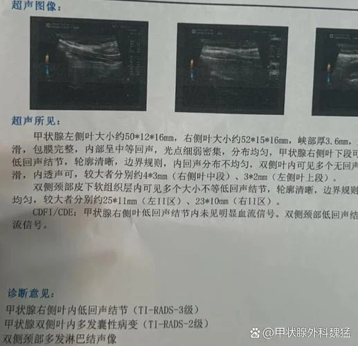 pgs后查免疫在哪检查_1