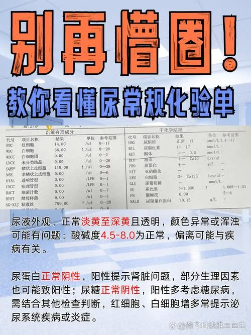 化验尿多少钱-化验尿费用
