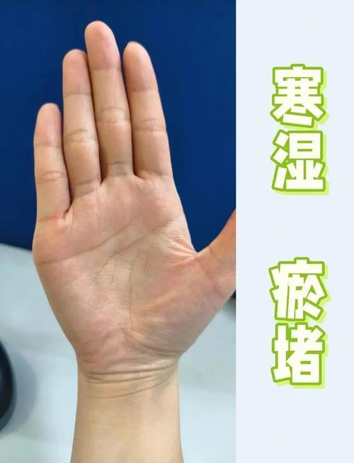 身体多病的手相-身体多病手相