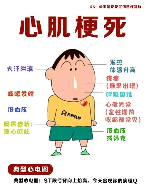 什么是急性心肌梗死_1