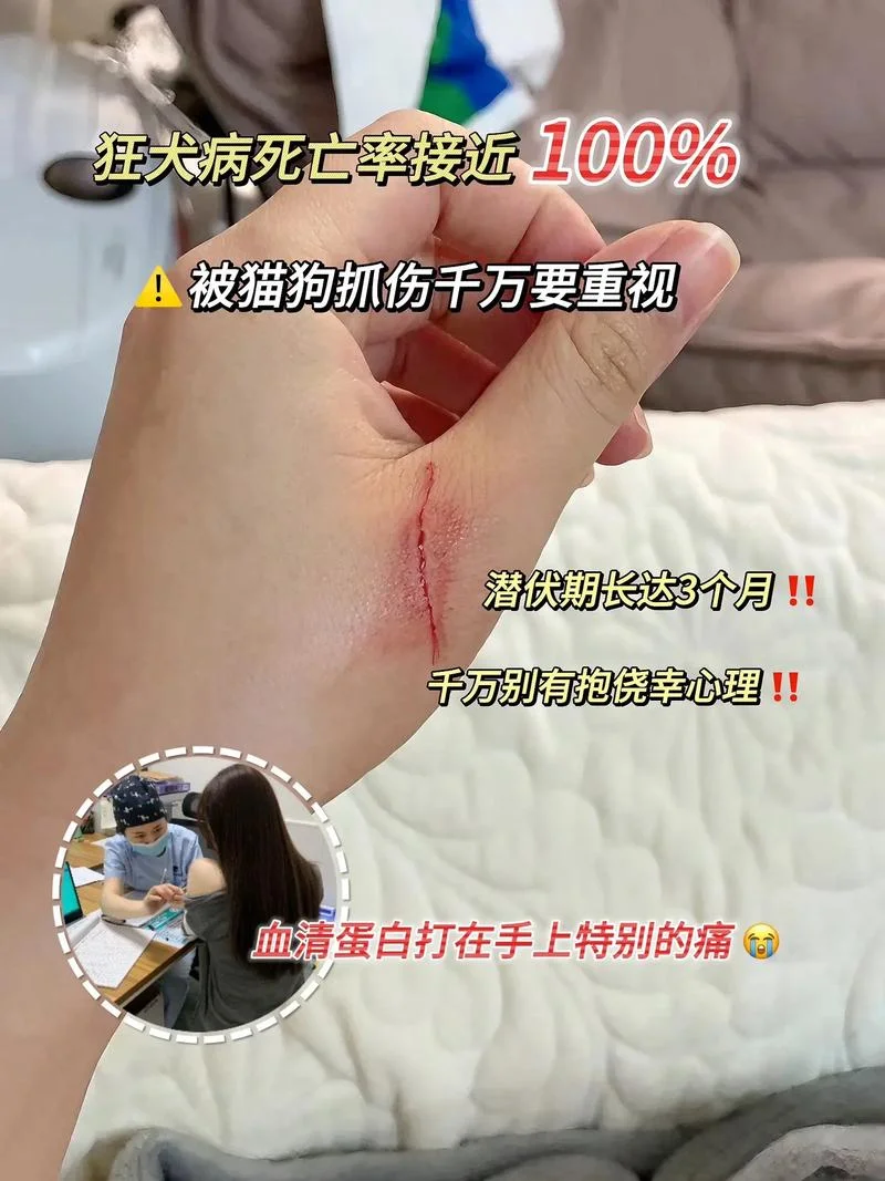 孕妇梦到被猫咬流黑血-孕妇梦猫咬流黑血