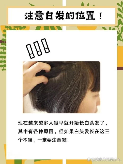 二十多岁就头发白怎么办_1