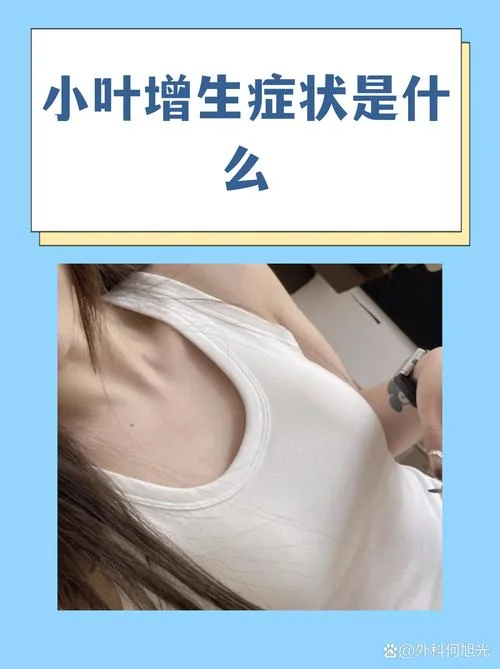 小叶增生刺痛怎么办-小叶刺痛缓解法