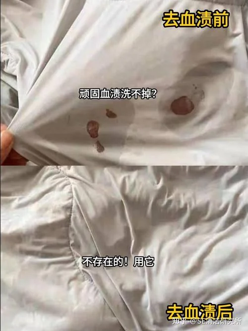 孕妇梦见衣服上见血-孕妇梦见衣上见血