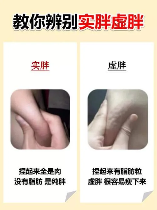什么是虚胖什么是实胖_2