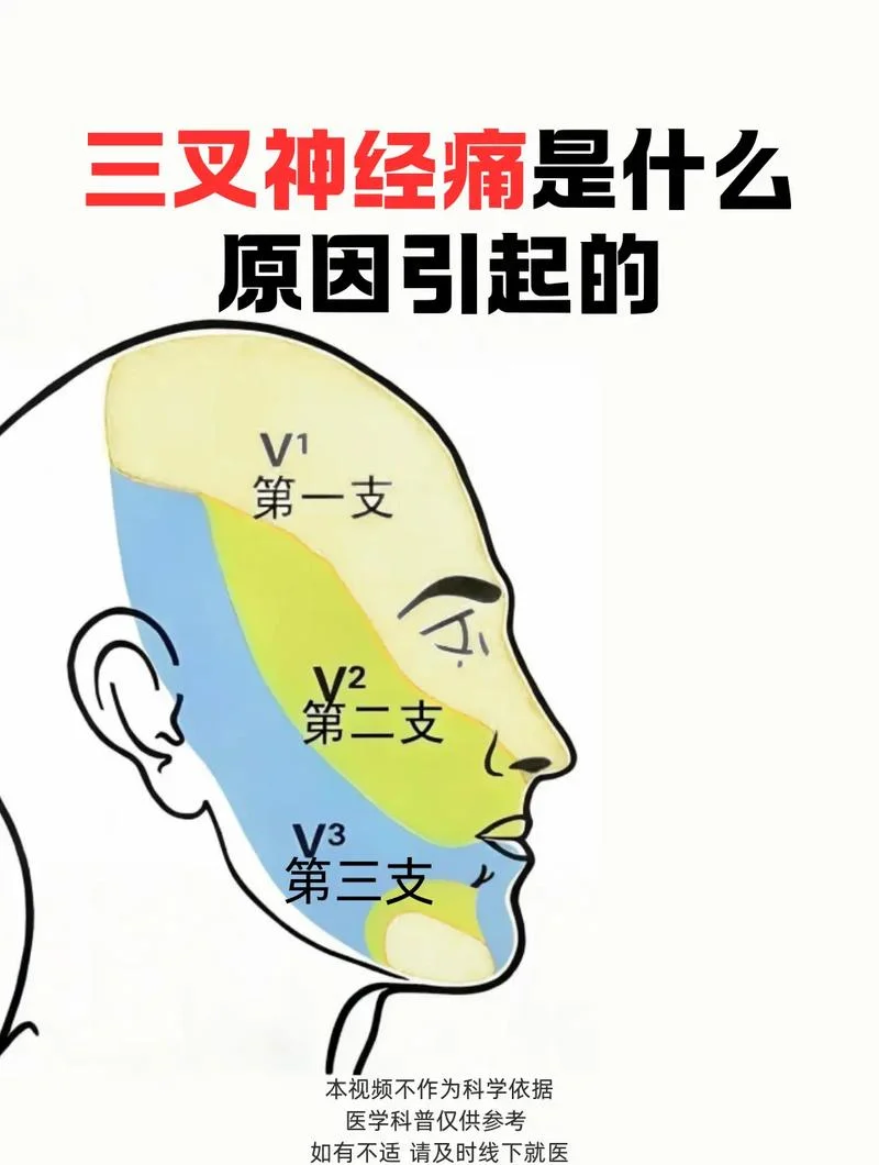 三叉神经出自哪个孔位_2