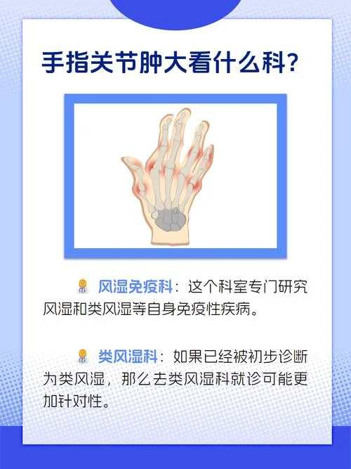 风湿类风湿如何查_1