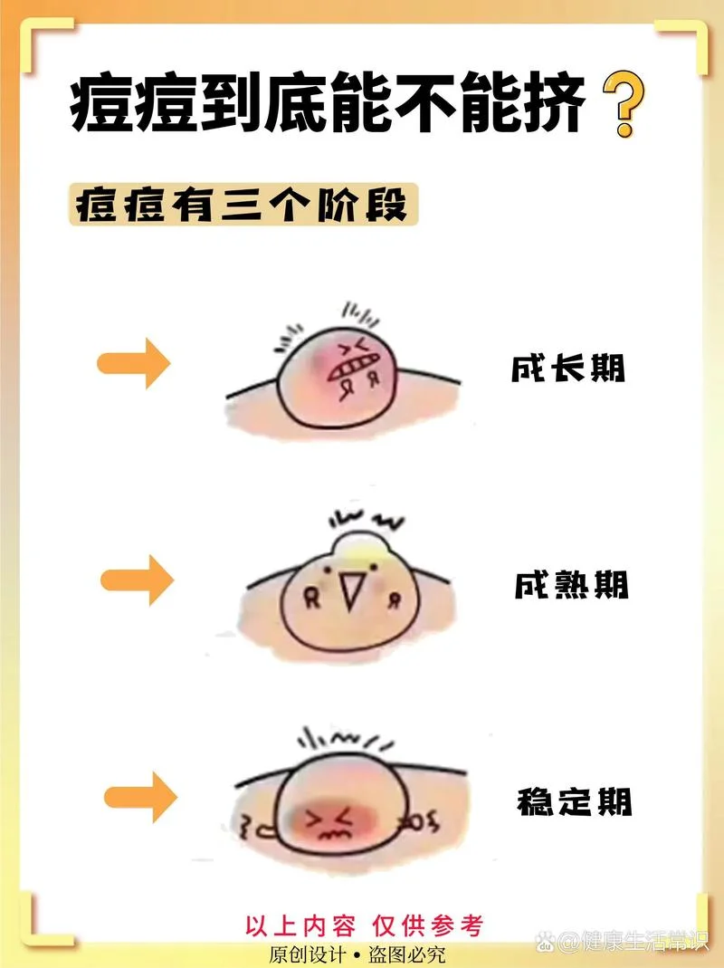 多大就不长痘痘了_1