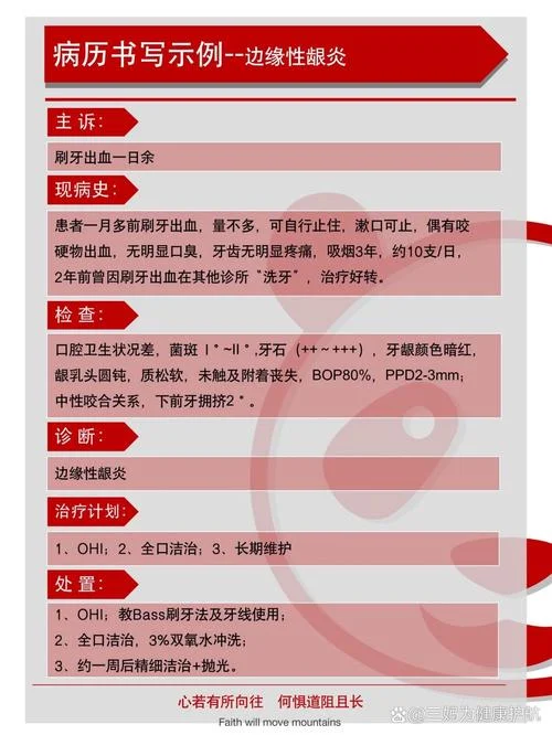 急性龈乳头炎感悟-急性龈乳头炎感悟