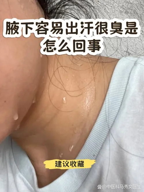 腋下大量出汗怎么办_2