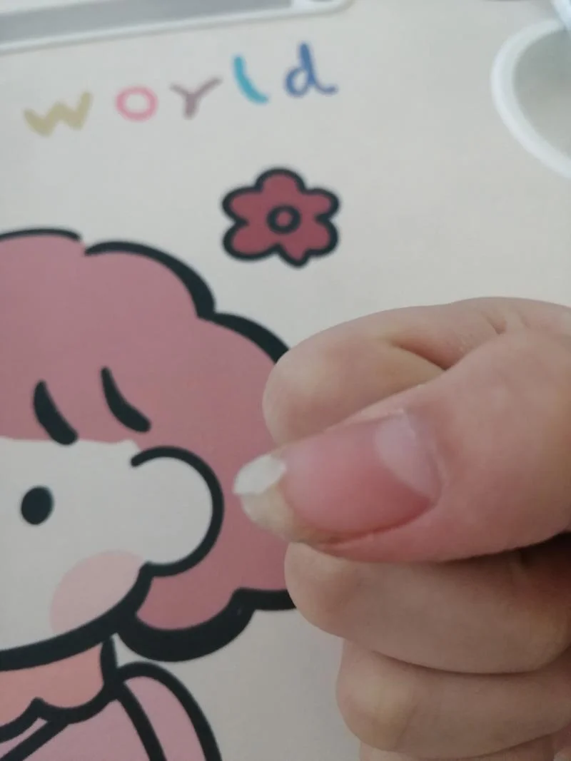 梦到指甲劈了_1