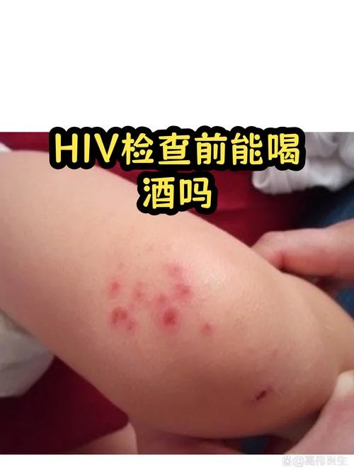 澳洲留学检查hiv吗_2