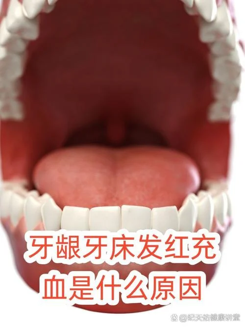 梦到牙龈肿和看到血_1