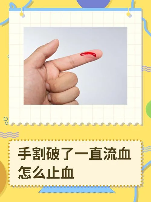 手流血了文案_1