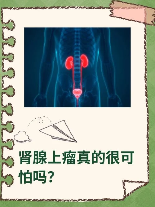 如何查肾上腺瘤_1