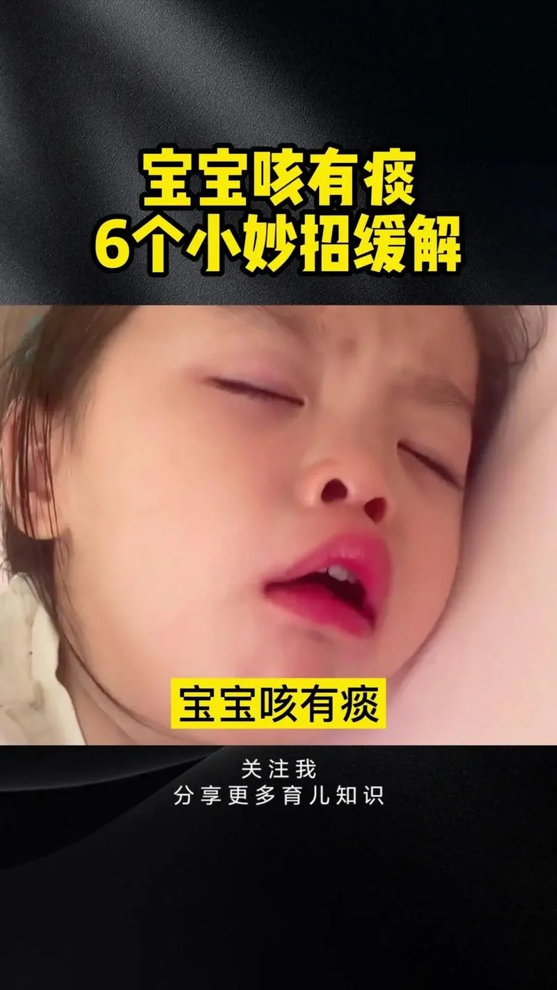 儿童冬季咳嗽怎么办-儿童冬咳怎么办