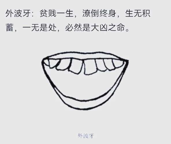 下牙不齐对面相_1