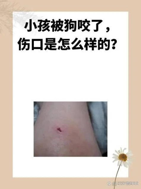 女人梦见狗咬腿出血是什么意思-女人梦狗咬腿出血